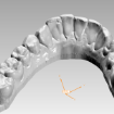 3D digitization of teeth impression dental