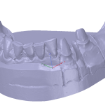 White light scan of dental impressions